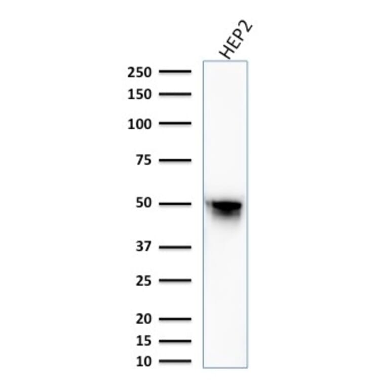 Western Blot - Anti-Vimentin Antibody [VM1170] - BSA and Azide free (A253489) - Antibodies.com