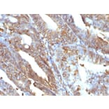 Immunohistochemistry - Anti-Vimentin Antibody [V9] - BSA and Azide free (A253490) - Antibodies.com