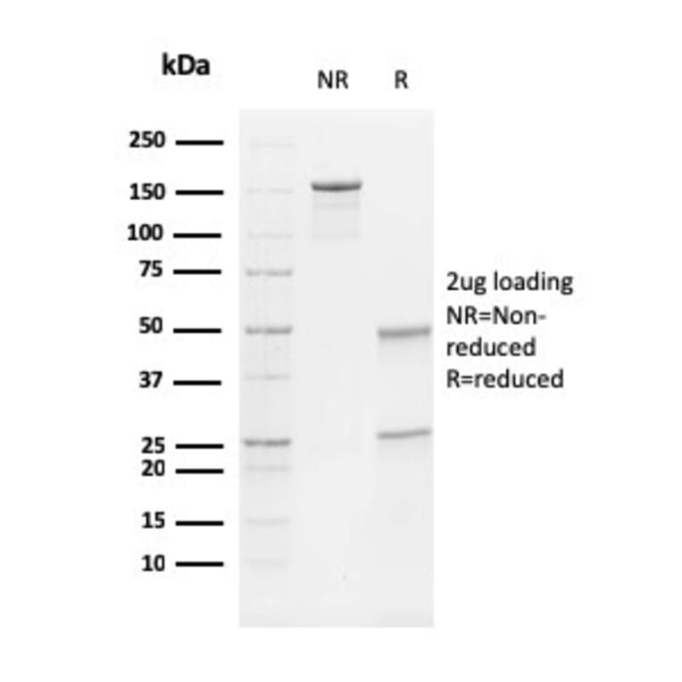 SDS-PAGE - Anti-Vimentin Antibody [V9] - BSA and Azide free (A253490) - Antibodies.com