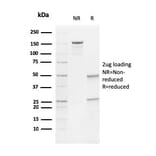 SDS-PAGE - Anti-Vimentin Antibody [V9] - BSA and Azide free (A253490) - Antibodies.com