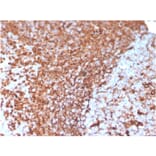 Immunohistochemistry - Anti-Vimentin Antibody [VIM/3736] - BSA and Azide free (A253491) - Antibodies.com