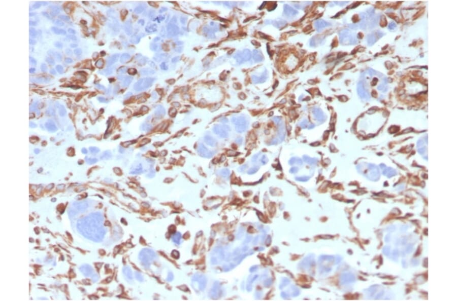 Immunohistochemistry - Anti-Vimentin Antibody [VIM/3736] - BSA and Azide free (A253491) - Antibodies.com
