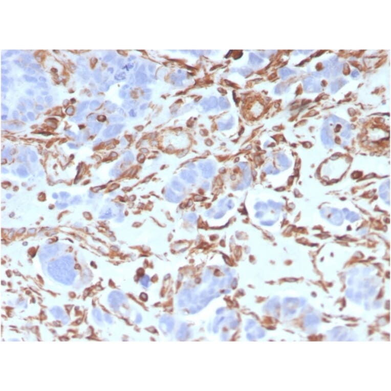 Immunohistochemistry - Anti-Vimentin Antibody [VIM/3736] - BSA and Azide free (A253491) - Antibodies.com