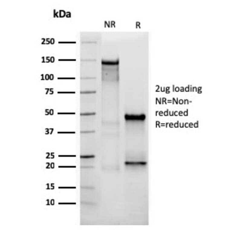 SDS-PAGE - Anti-Vimentin Antibody [VIM/3736] - BSA and Azide free (A253491) - Antibodies.com