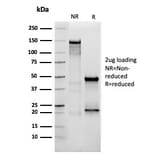 SDS-PAGE - Anti-Vimentin Antibody [VIM/3736] - BSA and Azide free (A253491) - Antibodies.com