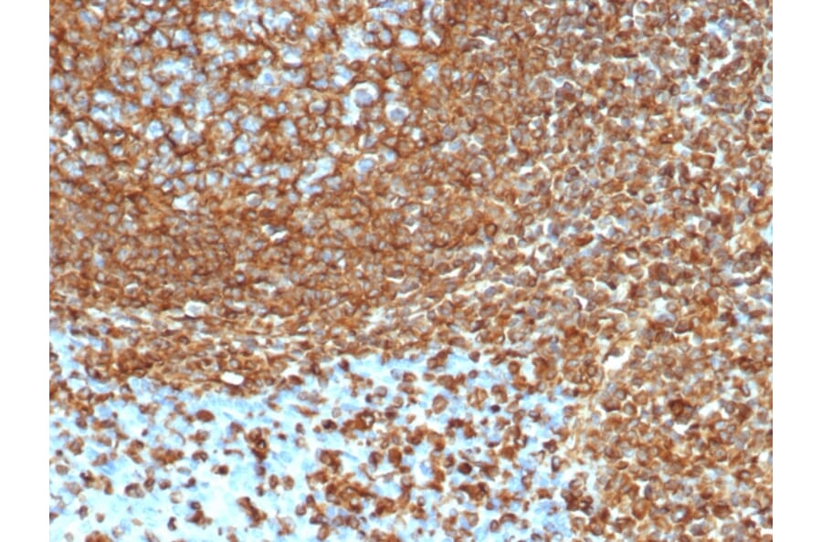 Immunohistochemistry - Anti-Vimentin Antibody [VIM/6430R] - BSA and Azide free (A253492) - Antibodies.com