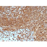 Immunohistochemistry - Anti-Vimentin Antibody [VIM/6430R] - BSA and Azide free (A253492) - Antibodies.com