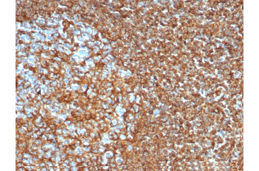Immunohistochemistry - Anti-Vimentin Antibody [VIM/6430R] - BSA and Azide free (A253492) - Antibodies.com