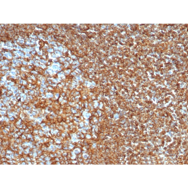 Immunohistochemistry - Anti-Vimentin Antibody [VIM/6430R] - BSA and Azide free (A253492) - Antibodies.com