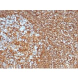 Immunohistochemistry - Anti-Vimentin Antibody [VIM/6430R] - BSA and Azide free (A253492) - Antibodies.com