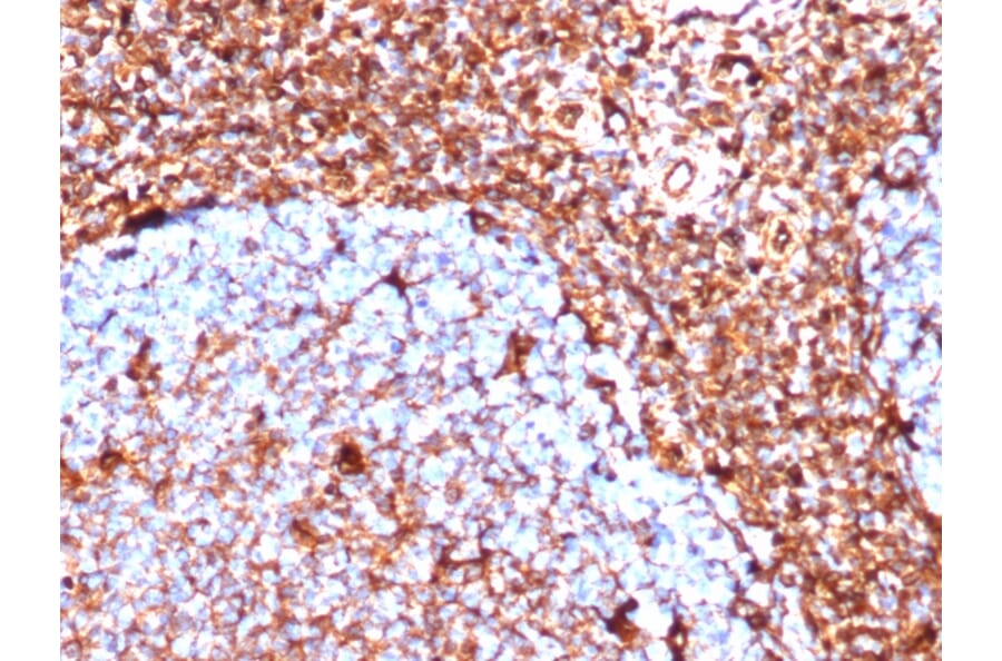 Immunohistochemistry - Anti-Vimentin Antibody [VIM/6430R] - BSA and Azide free (A253491) - Antibodies.com