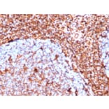 Immunohistochemistry - Anti-Vimentin Antibody [VIM/6430R] - BSA and Azide free (A253491) - Antibodies.com