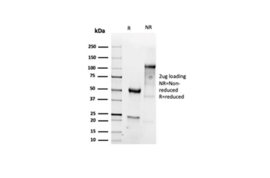 SDS-PAGE - Anti-Vimentin Antibody [VIM/6430R] - BSA and Azide free (A253492) - Antibodies.com