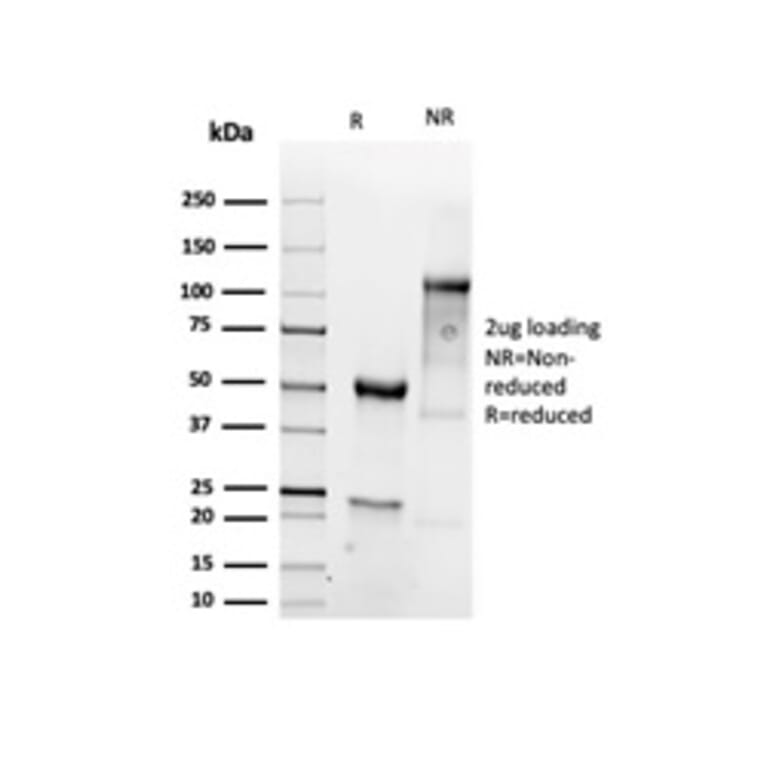 SDS-PAGE - Anti-Vimentin Antibody [VIM/6430R] - BSA and Azide free (A253492) - Antibodies.com