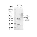 SDS-PAGE - Anti-Vimentin Antibody [VIM/6430R] - BSA and Azide free (A253492) - Antibodies.com