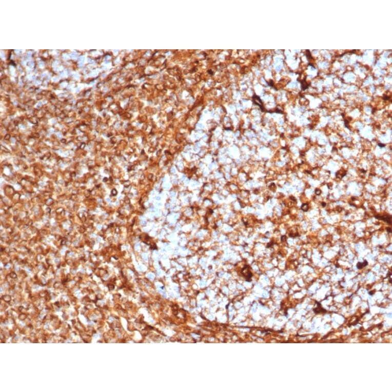 Immunohistochemistry - Anti-Vimentin Antibody [VIM/6576R] - BSA and Azide free (A253493) - Antibodies.com