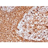 Immunohistochemistry - Anti-Vimentin Antibody [VIM/6576R] - BSA and Azide free (A253493) - Antibodies.com