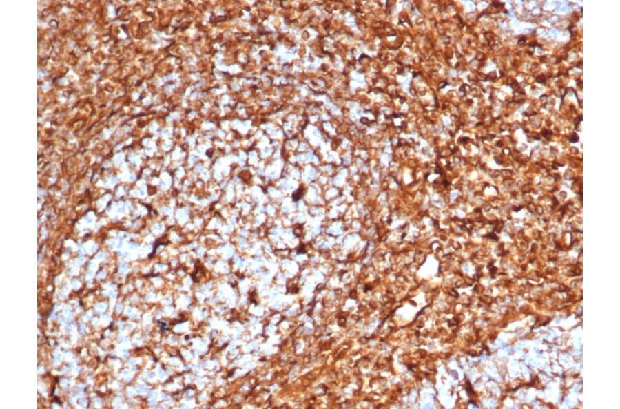 Immunohistochemistry - Anti-Vimentin Antibody [VIM/6576R] - BSA and Azide free (A253492) - Antibodies.com