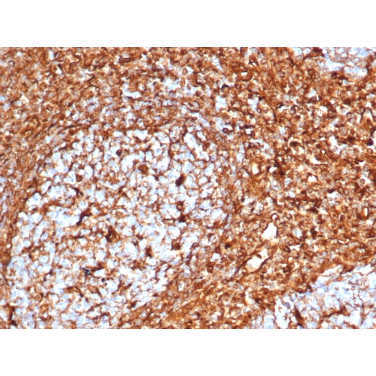 Immunohistochemistry - Anti-Vimentin Antibody [VIM/6576R] - BSA and Azide free (A253492) - Antibodies.com