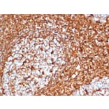 Immunohistochemistry - Anti-Vimentin Antibody [VIM/6576R] - BSA and Azide free (A253492) - Antibodies.com