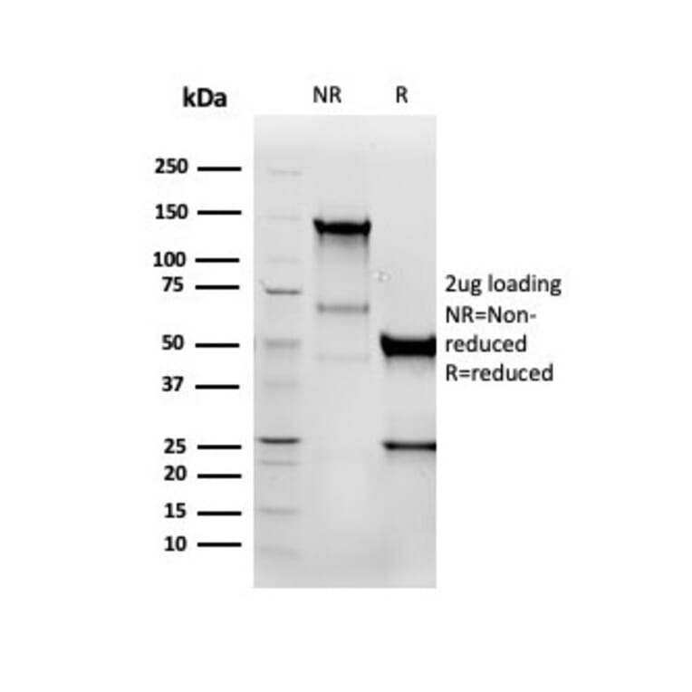 SDS-PAGE - Anti-Vimentin Antibody [VIM/6576R] - BSA and Azide free (A253493) - Antibodies.com