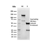 SDS-PAGE - Anti-Vimentin Antibody [VIM/6576R] - BSA and Azide free (A253493) - Antibodies.com