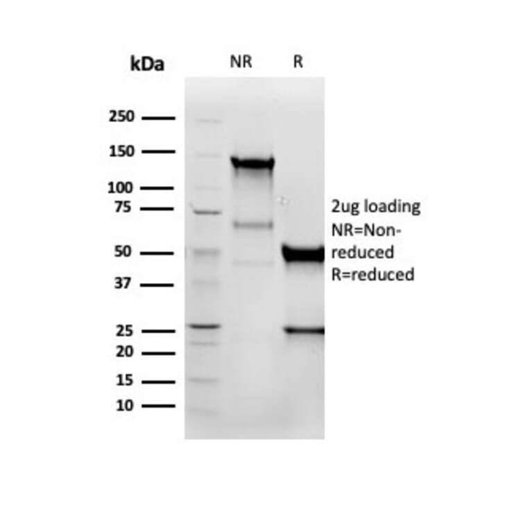 Western Blot - Anti-Vimentin Antibody [VIM/6576R] - BSA and Azide free (A253493) - Antibodies.com