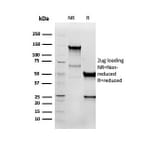 Western Blot - Anti-Vimentin Antibody [VIM/6576R] - BSA and Azide free (A253493) - Antibodies.com