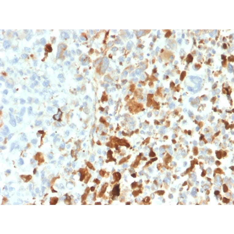 Immunohistochemistry - Anti-Vimentin Antibody [VIM/1937R] - BSA and Azide free (A253494) - Antibodies.com