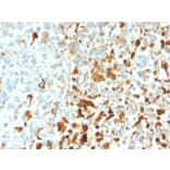 Immunohistochemistry - Anti-Vimentin Antibody [VIM/1937R] - BSA and Azide free (A253494) - Antibodies.com