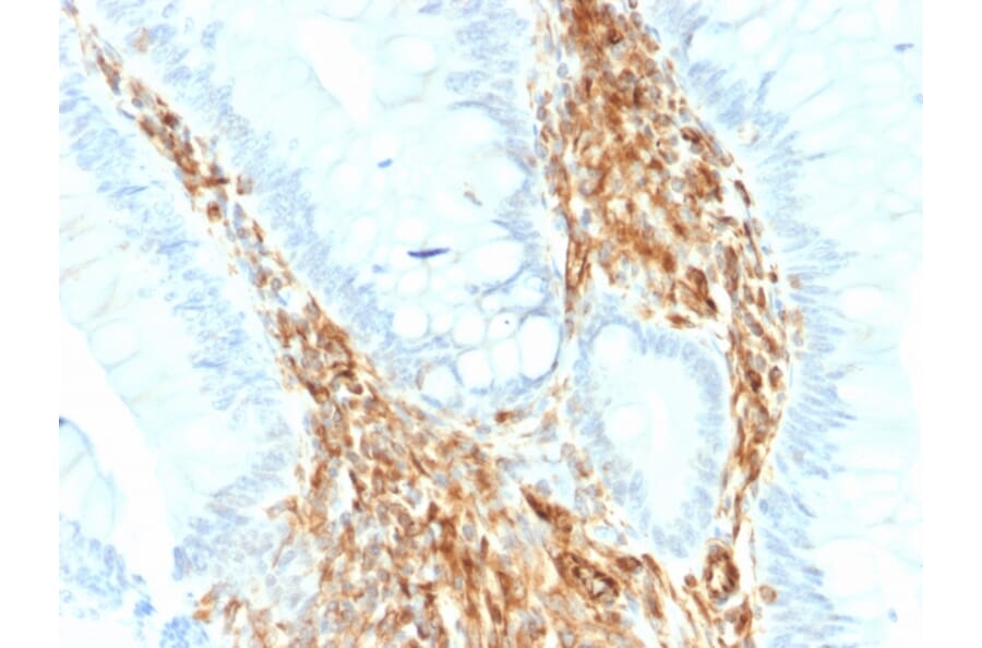 Immunohistochemistry - Anti-Vimentin Antibody [VIM/1937R] - BSA and Azide free (A253493) - Antibodies.com