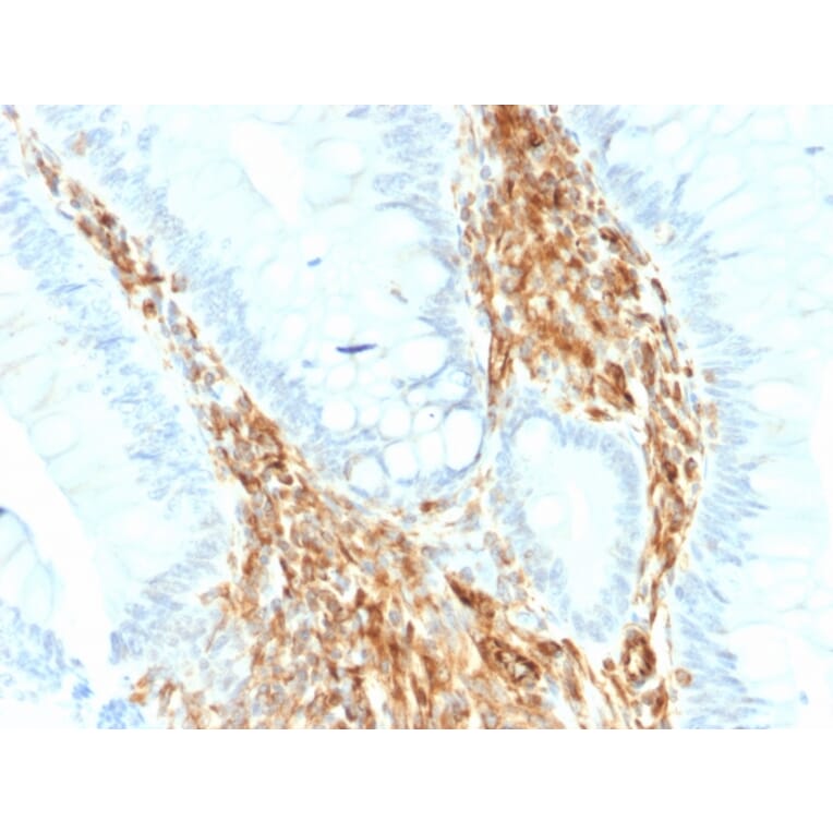 Immunohistochemistry - Anti-Vimentin Antibody [VIM/1937R] - BSA and Azide free (A253493) - Antibodies.com