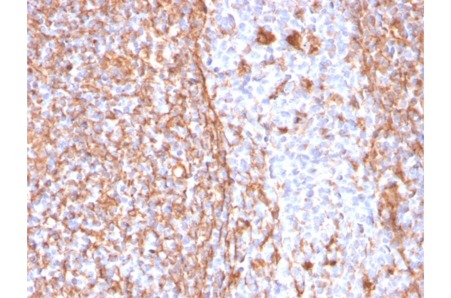 Immunohistochemistry - Anti-Vimentin Antibody [VIM/1937R] - BSA and Azide free (A253494) - Antibodies.com