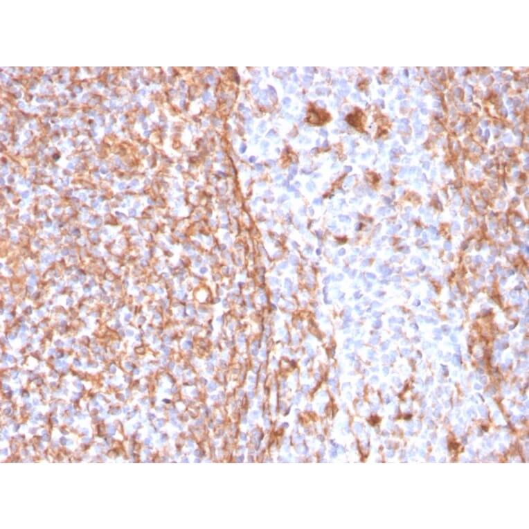 Immunohistochemistry - Anti-Vimentin Antibody [VIM/1937R] - BSA and Azide free (A253494) - Antibodies.com