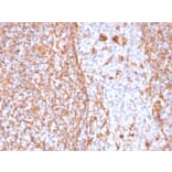 Immunohistochemistry - Anti-Vimentin Antibody [VIM/1937R] - BSA and Azide free (A253494) - Antibodies.com