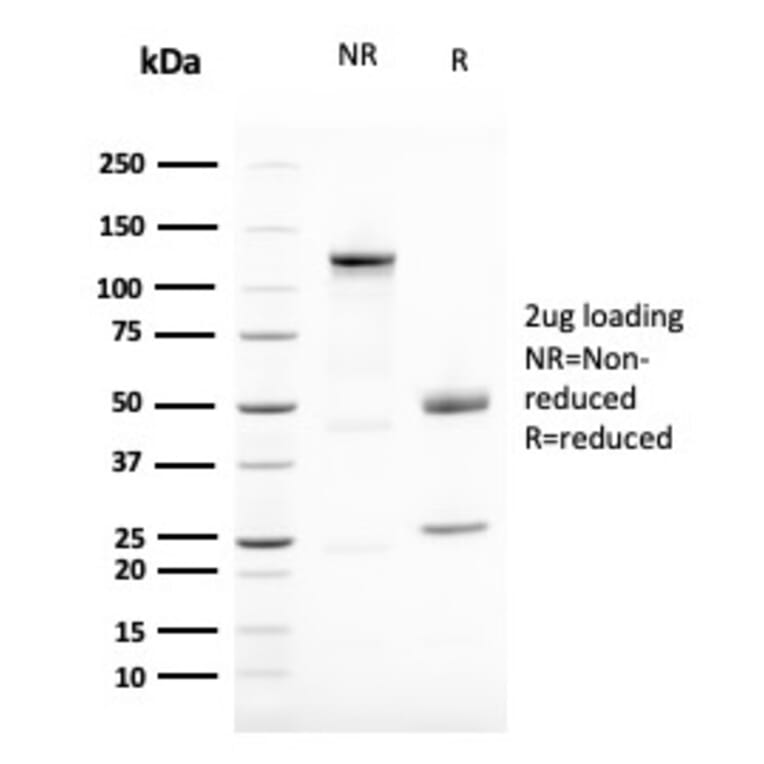 SDS-PAGE - Anti-Vimentin Antibody [VIM/1937R] - BSA and Azide free (A253494) - Antibodies.com