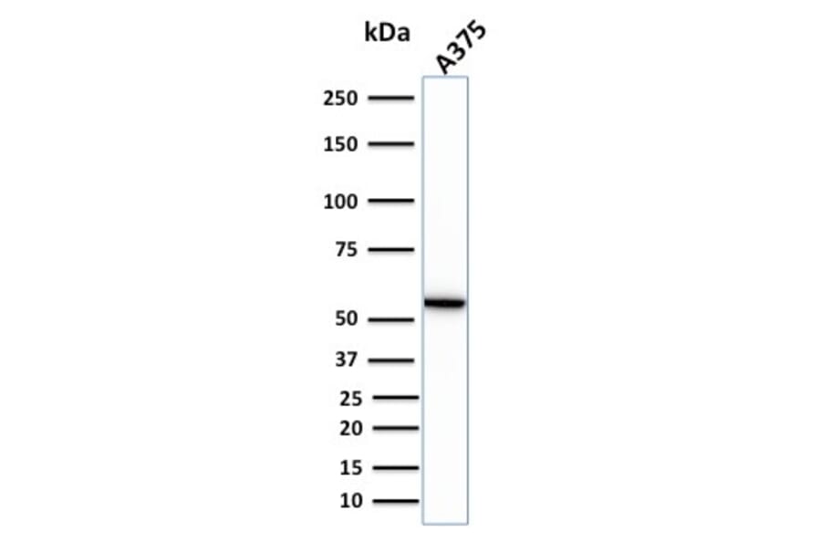 Western Blot - Anti-Vimentin Antibody [VIM/1937R] - BSA and Azide free (A253494) - Antibodies.com