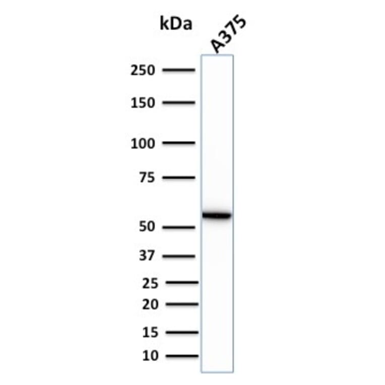 Western Blot - Anti-Vimentin Antibody [VIM/1937R] - BSA and Azide free (A253494) - Antibodies.com