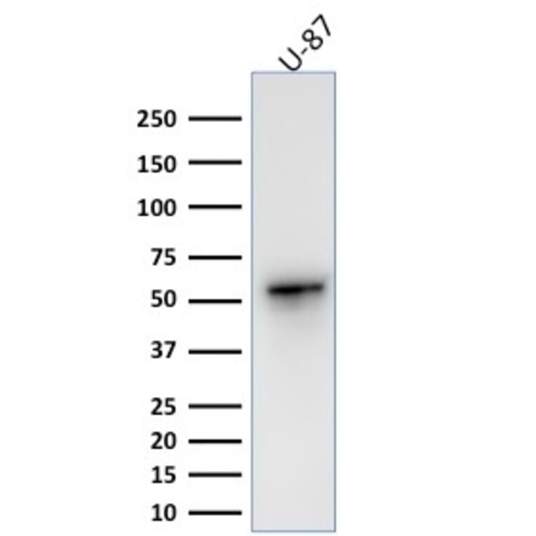 Western Blot - Anti-Vimentin Antibody [VIM/1937R] - BSA and Azide free (A253494) - Antibodies.com