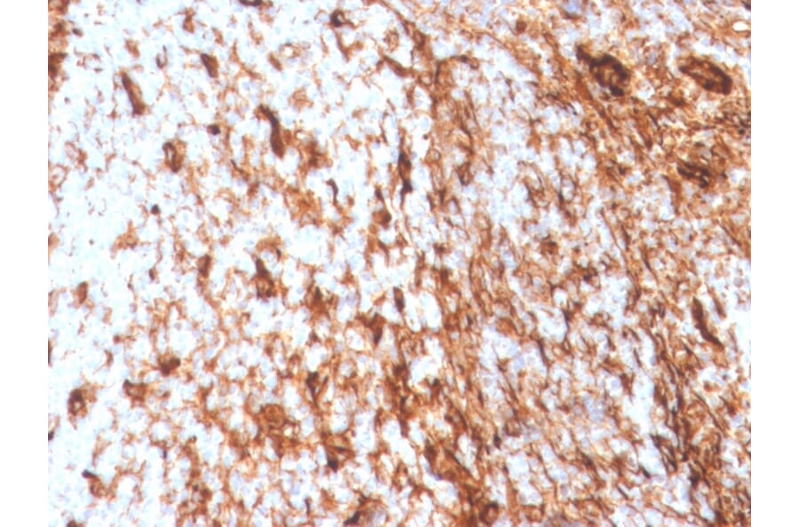 Immunohistochemistry - Anti-Vimentin Antibody [VIM/4388R] - BSA and Azide free (A250315) - Antibodies.com