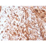 Immunohistochemistry - Anti-Vimentin Antibody [VIM/4388R] - BSA and Azide free (A250315) - Antibodies.com
