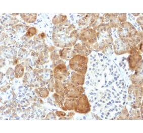Immunohistochemistry - Anti-VLDL Receptor Antibody [VLDLR/1337] - BSA and Azide free (A253495) - Antibodies.com