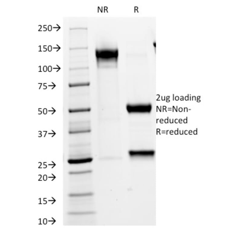 SDS-PAGE - Anti-VLDL Receptor Antibody [VLDLR/1337] - BSA and Azide free (A253496) - Antibodies.com