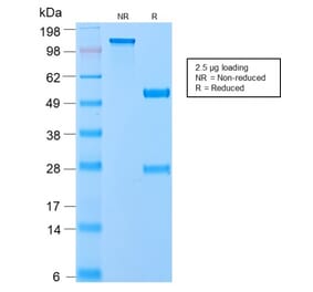 SDS-PAGE - Anti-VLDL Receptor Antibody [VLDLR/2896R] - BSA and Azide free (A253496) - Antibodies.com