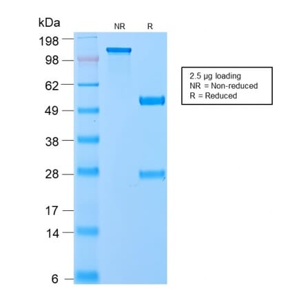 SDS-PAGE - Anti-VLDL Receptor Antibody [VLDLR/2896R] - BSA and Azide free (A253496) - Antibodies.com