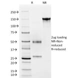 SDS-PAGE - Anti-Von Willebrand Factor Antibody [VWF/2480] - BSA and Azide free (A253498) - Antibodies.com