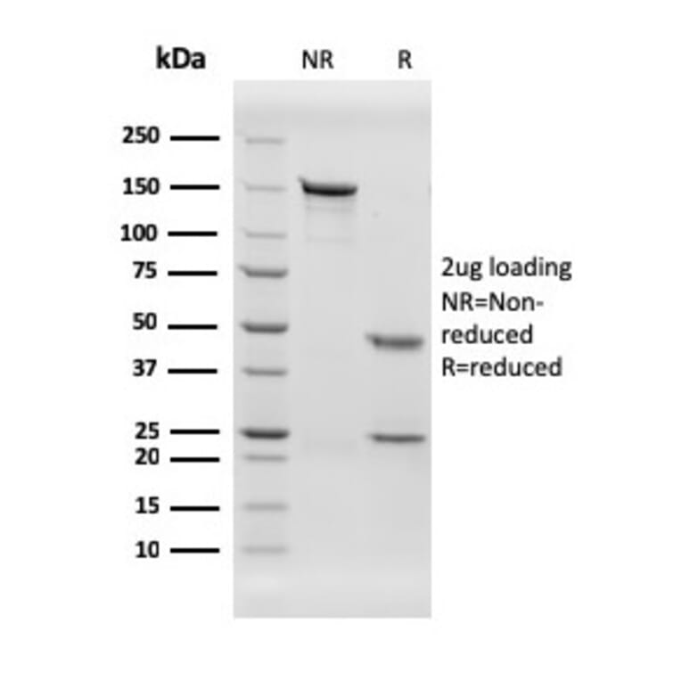 SDS-PAGE - Anti-Von Willebrand Factor Antibody [rVWF/2480] - BSA and Azide free (A253499) - Antibodies.com