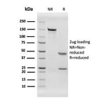 SDS-PAGE - Anti-Von Willebrand Factor Antibody [rVWF/2480] - BSA and Azide free (A253499) - Antibodies.com