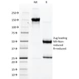 SDS-PAGE - Anti-Von Willebrand Factor Antibody [3E2D10] - BSA and Azide free (A253500) - Antibodies.com