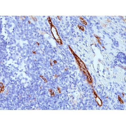 Immunohistochemistry - Anti-Von Willebrand Factor Antibody [SPM577] - BSA and Azide free (A253501) - Antibodies.com